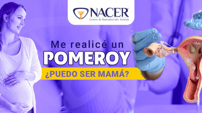 ME REALICÉ UN POMEROY ¿PUEDO SER MAMÁ?